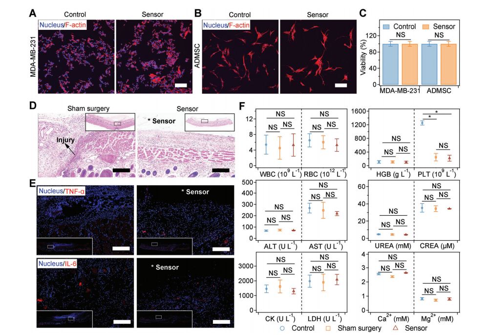 機(jī)械退火破解氨基酸晶體壓電難題！南京大學(xué)造出可生物降解的壓電力傳感器